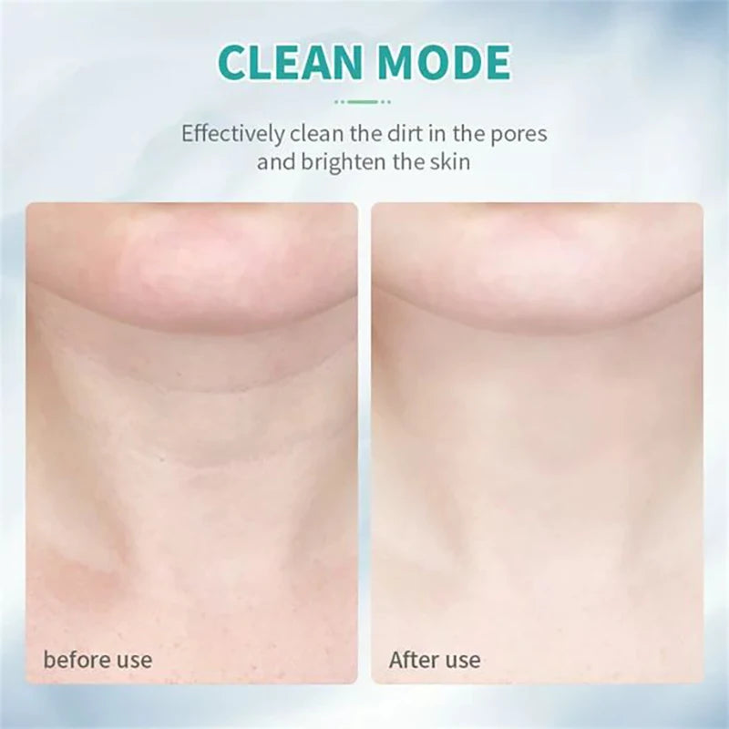 EMS Light Facial Lifting Device