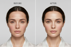 Red Light Therapy Face Mask