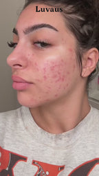 Red Light Therapy Face Mask